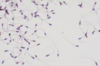 Spermatozoïdes humains x200